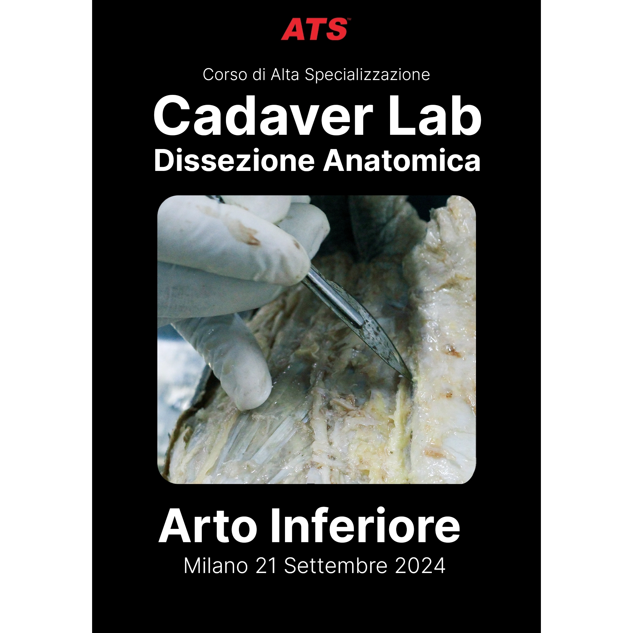 Arto-Inferiore-Cadaver-Lab-ATS