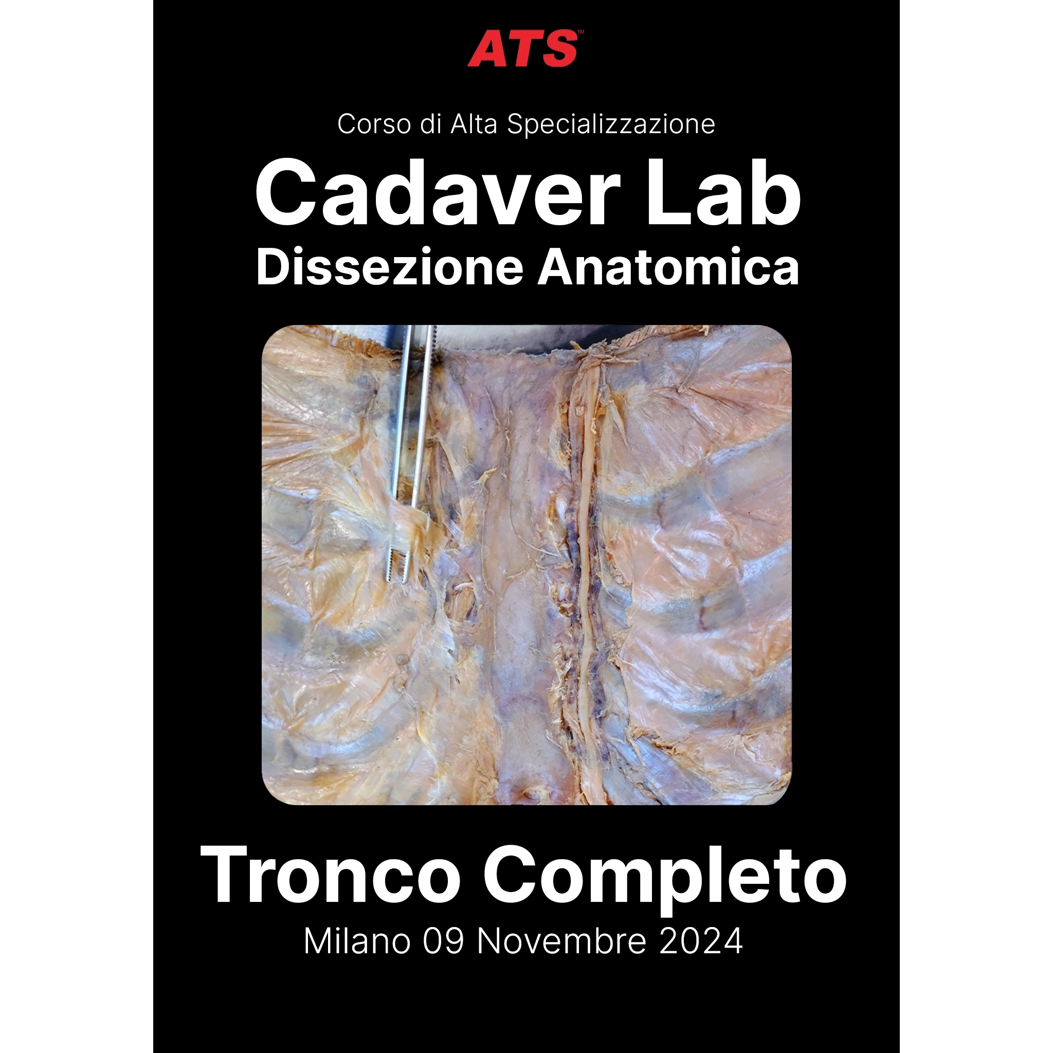 Cadaver-Lab-Tronco-ATS