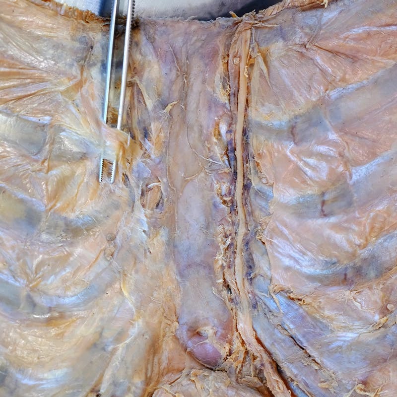 Tronco-Dissezione-Anatomica