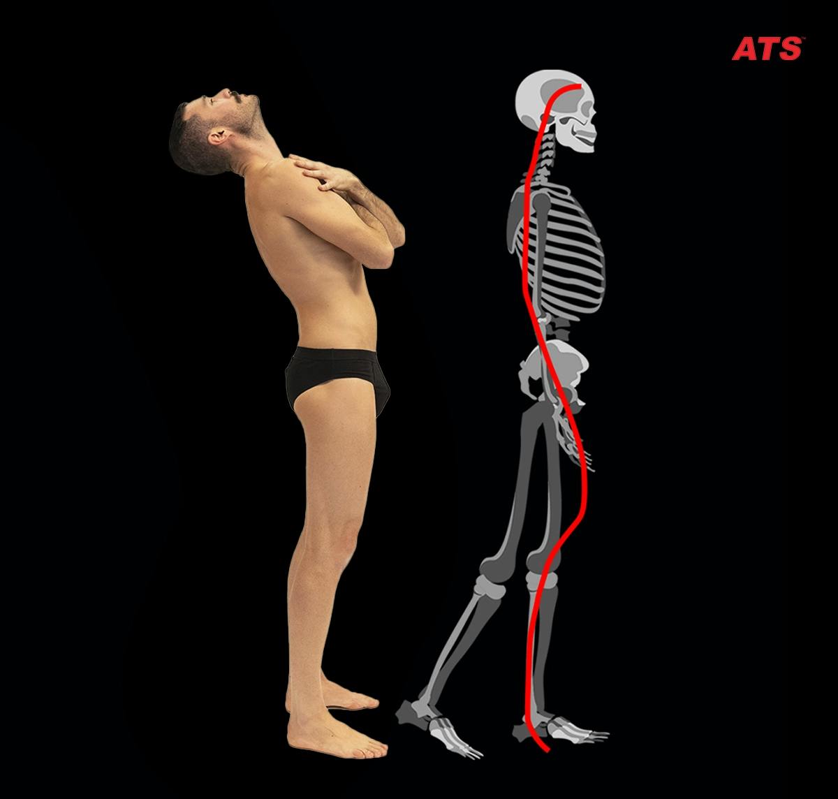 Catena-Estensoria-Anatomia